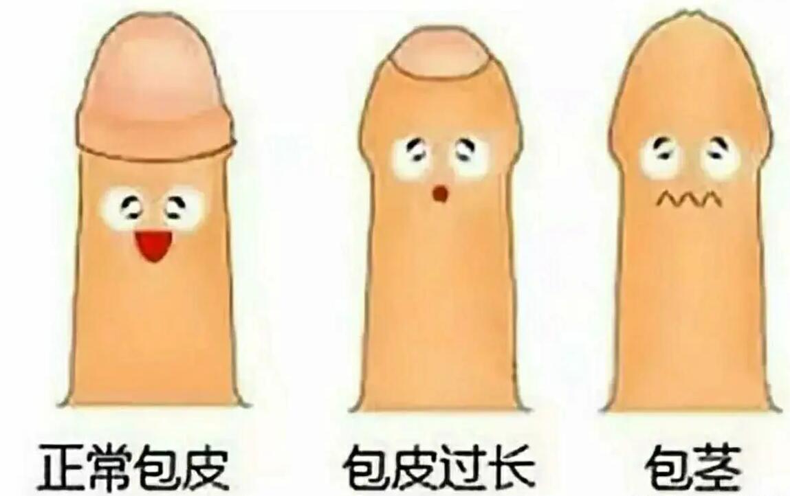 生殖手术